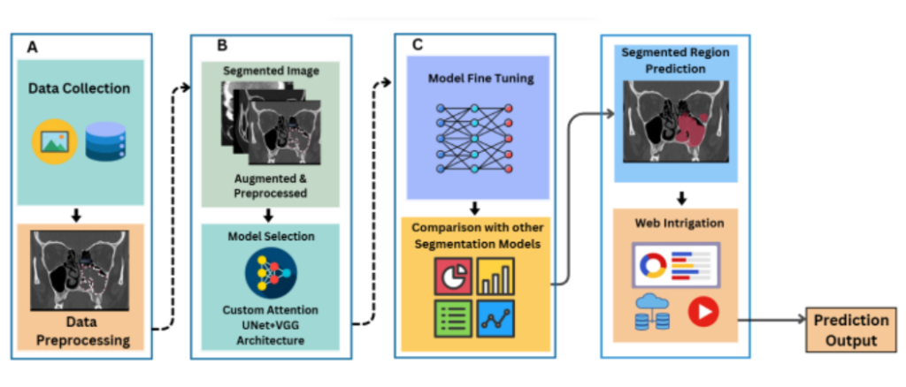 Nasal Sinus Segmentation Diagram